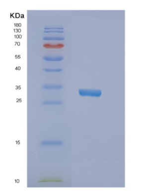 Recombinant Human NRBF2 Protein
