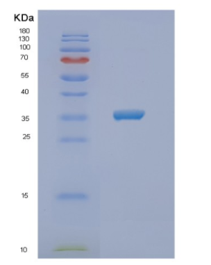 Recombinant Human NSDHL Protein