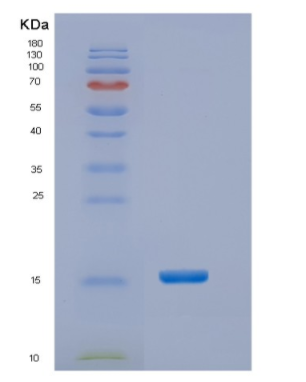 Recombinant Human NTS Protein