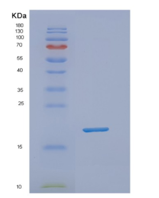 Recombinant Human NUDT1 Protein