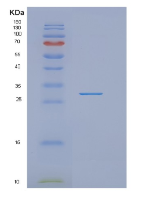 Recombinant Human NUDT21 Protein