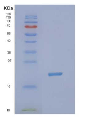 Recombinant Human NUDT3 Protein