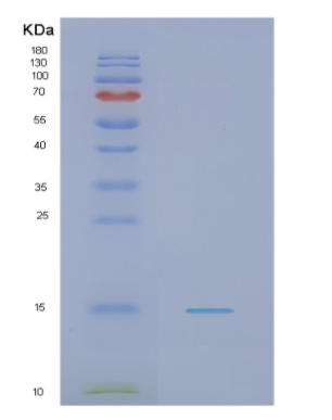 Recombinant Human NDUFS5 Protein