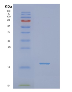 Recombinant Human NHLH1 Protein