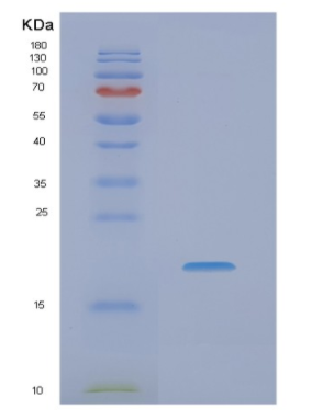 Recombinant Human NME4 Protein