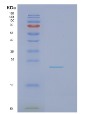 Recombinant Human NOP16 Protein