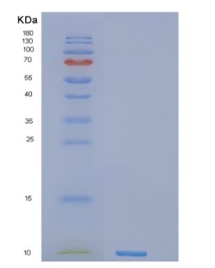 Recombinant Human NREP Protein
