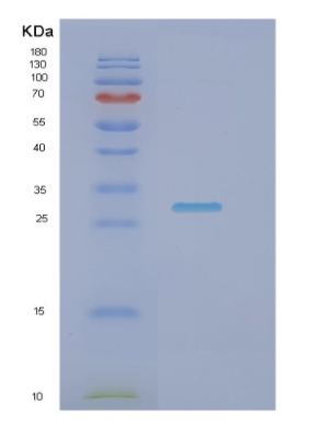 Recombinant Human NRIP3 Protein