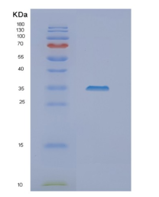 Recombinant Human NSL1 Protein