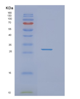 Recombinant Human NT5E Protein