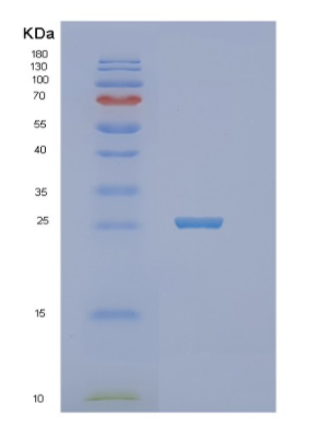 Recombinant E.coli nth Protein