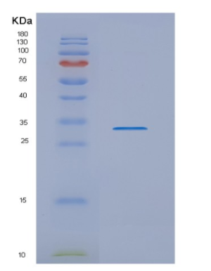 Recombinant Human NUBP2 Protein