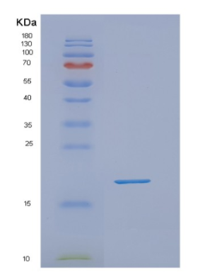 Recombinant Human NUDT10 Protein