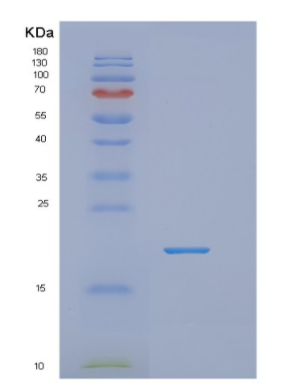 Recombinant Human NUDT2 Protein