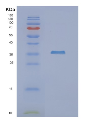 Recombinant Human NUDT9 Protein