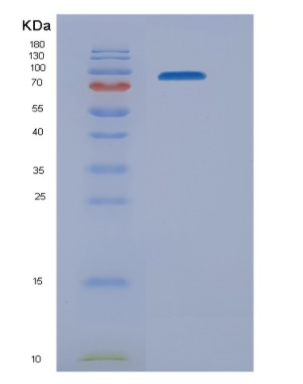 Recombinant Mouse Nrp1 Protein