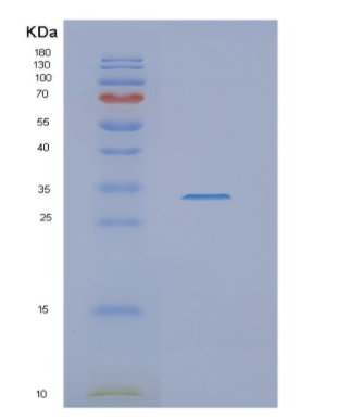 Recombinant Human NSMCE1 Protein