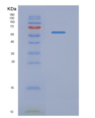 Recombinant Human NMT1 Protein