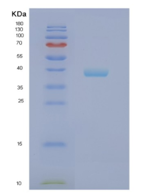 Recombinant Human NPL Protein