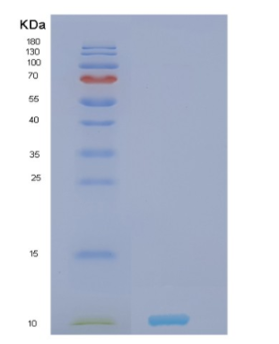 Recombinant Human NRGN Protein