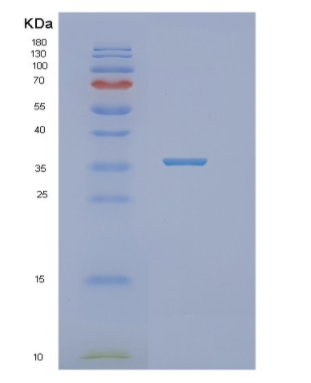 Recombinant Human NTHL1 Protein