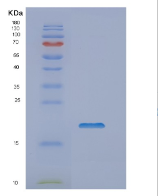 Recombinant Human NUDCD2 Protein