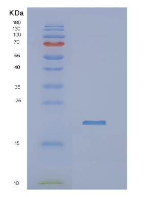 Recombinant Human NUDT4 Protein