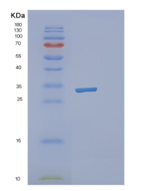 Recombinant Human NCEH1 Protein