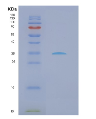 Recombinant Human NQO2 Protein