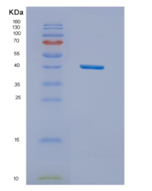 Recombinant Human NUDC Protein