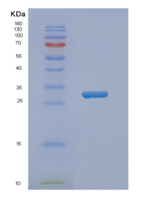 Recombinant Human NKX3-1 Protein