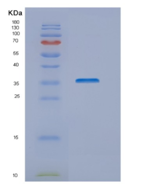 Recombinant Human NUBP1 Protein