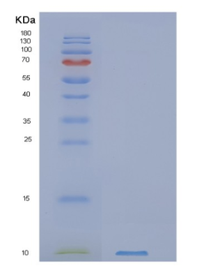 Recombinant Human NUP62CL Protein