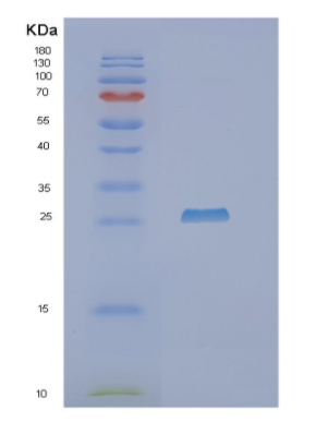 Recombinant Human NTAL Protein