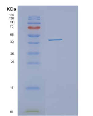 Recombinant Human OBFC1 Protein