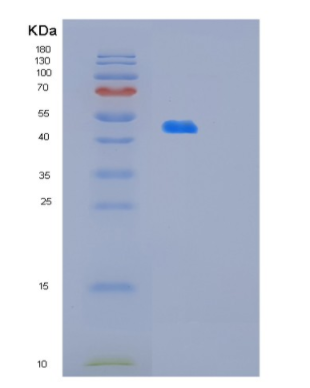 Recombinant Human OLA1 Protein