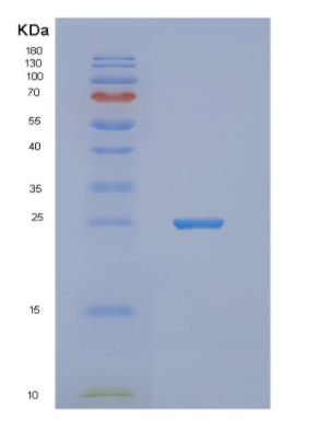 Recombinant Human NUDT16L1 Protein