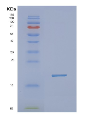 Recombinant Human NXT1 Protein