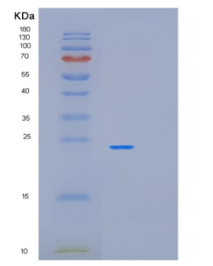 Recombinant Human OLR1 Protein