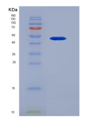 Recombinant Oncostatin M (OSM)