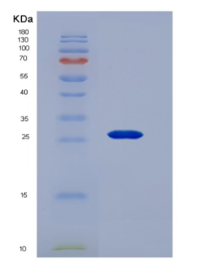 Recombinant Osteoprotegerin (OPG)