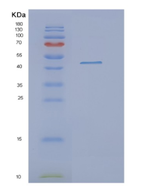 Recombinant Human OAT Protein