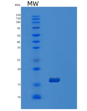 Recombinant Human ORAOV1 Protein