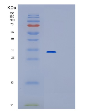 Recombinant Human OSR2 Protein