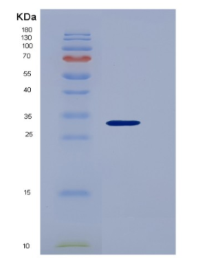 Recombinant Platelet Derived Growth Factor Subunit B (PDGFB)