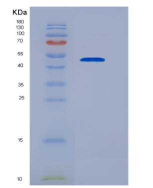 Recombinant Platelet Derived Growth Factor D (PDGFD)