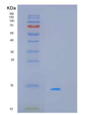 Recombinant Human PDCD5 Protein