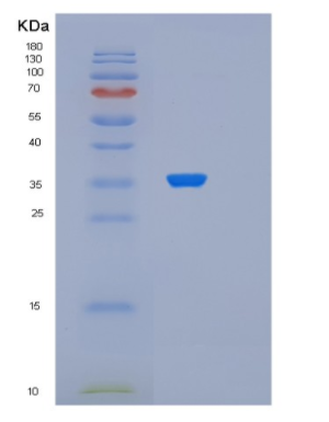 Recombinant Human PDCL Protein