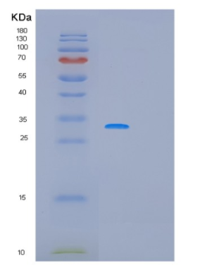 Recombinant Human PCNA Protein