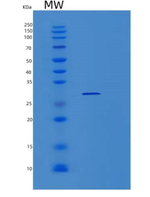 Recombinant Human PCMTD1 Protein